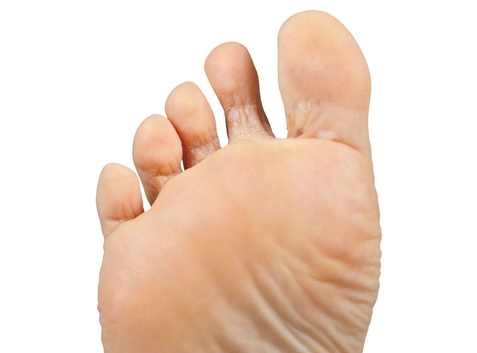 Funger-good-and-trial-and-heigh-cream-zxcvbnmqwert